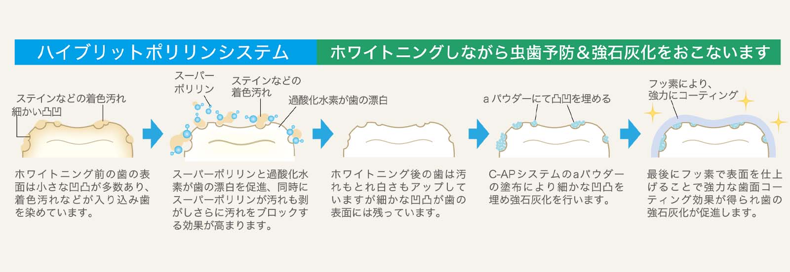 ハイブリッドポリリンホワイトニングとは